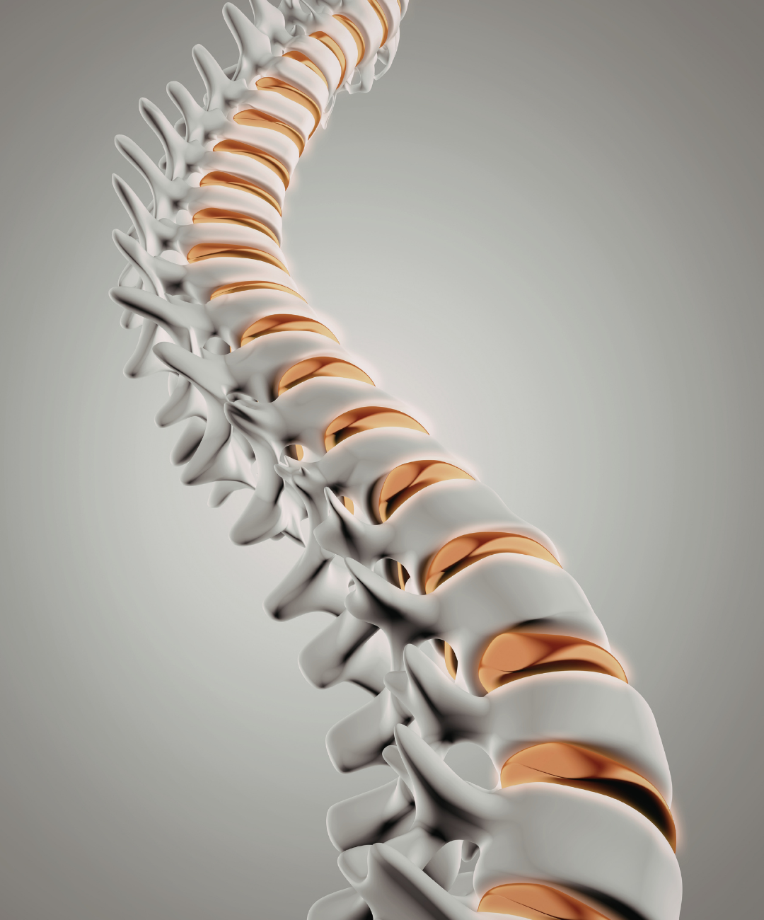Spine Surgery