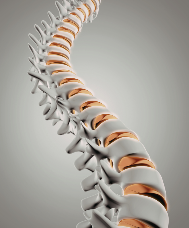 Spine Surgery